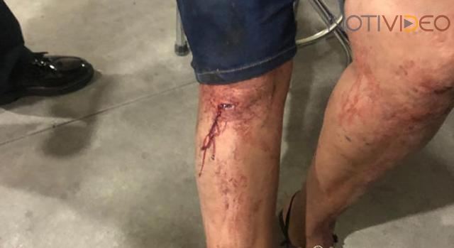 Policías rescatan a una  mujer agredida por su ex pareja