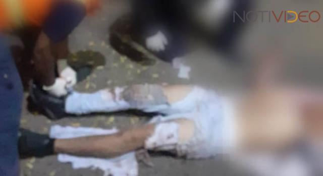 Joven es baleado por sus amigos al salir de una fiesta 