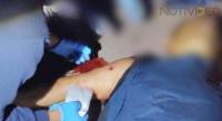 Atacan a balazos a policía auxiliar  y queda lesionado