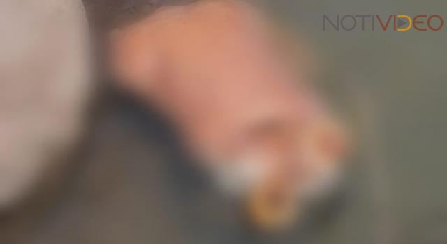 Localizan partes de un cuerpo desmembrado en la presa 